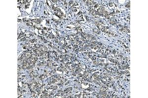 IHC analysis of eRF1/ETF1 using anti-eRF1/ETF1 antibody (ABIN7602626). (ETF1 Antikörper  (AA 9-342))