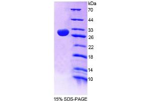 SDS-PAGE (SDS) image for 2',3'-Cyclic Nucleotide 3' phosphodiesterase (CNP) (AA 186-421) protein (His tag) (ABIN6239070) (Cnpase Protein (AA 186-421) (His tag))