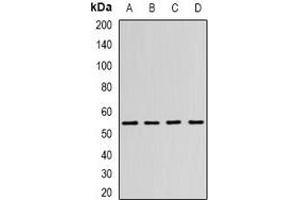 Western blot analysis of N-WASP expression in SW480 (A), MCF7 (B), mouse brain (C), mouse kidney (D) whole cell lysates.