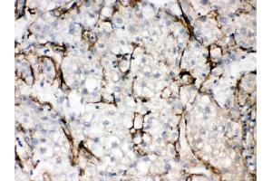 Anti- SLC10A1 Picoband antibody, IHC(P) IHC(P): Human Liver Cancer Tissue (SLC10A1 Antikörper  (C-Term))