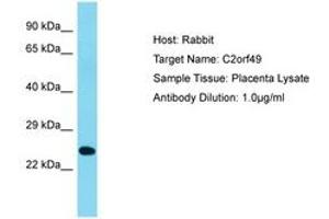 Image no. 1 for anti-Chromosome 2 Open Reading Frame 49 (C2orf49) (AA 93-142) antibody (ABIN6750665) (C2orf49 Antikörper  (AA 93-142))
