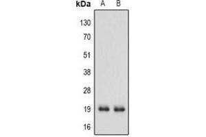 Western blot analysis of IFN alpha 1 expression in MCF7 (A), A549 (B) whole cell lysates. (IFNA1 Antikörper  (C-Term))