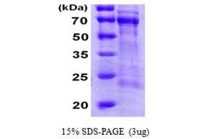 CDC25A Protein (AA 1-524) (His tag)