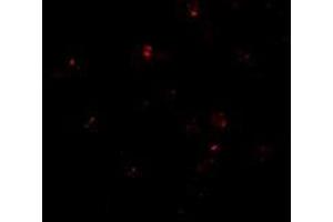 Immunofluorescence of PEN2 in K562 cells with this product at 20 μg/ml. (PEN2 Antikörper  (C-Term))