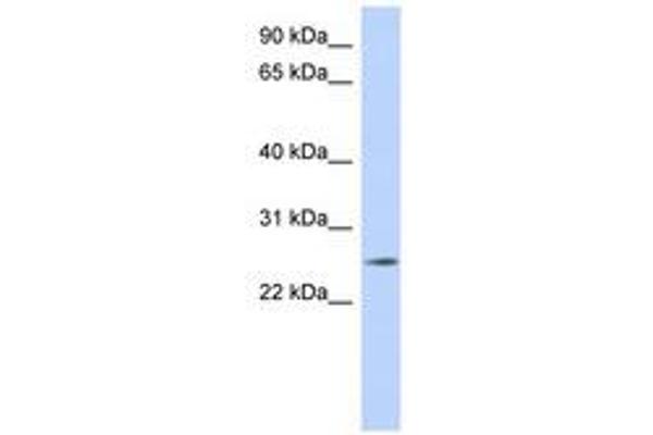 NKAIN4 anticorps  (C-Term)