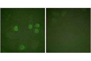 Immunofluorescence analysis of HeLa cells, using Cyclin B1 (Ab-126) Antibody. (Cyclin B1 Antikörper  (AA 91-140))