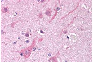 Human Brain, Cortex (formalin-fixed, paraffin-embedded) stained with SCN5A antibody ABIN290512 at 5-10 ug/ml followed by biotinylated anti-goat IgG secondary antibody ABIN481715, alkaline phosphatase-streptavidin and chromogen. (SCN5A Antikörper  (AA 1548-1558))