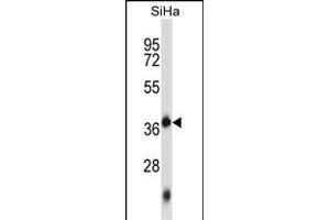 DNTTIP1 Antibody (Center) (ABIN657126 and ABIN2846270) western blot analysis in SiHa cell line lysates (35 μg/lane). (DNTTIP1 Antikörper  (AA 145-174))