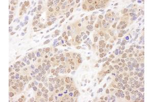 Immunohistochemistry (IHC) image for anti-Proteasome (Prosome, Macropain) Subunit, beta Type, 7 (PSMB7) (AA 150-200) antibody (ABIN7453543)