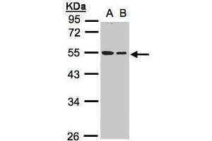 WB Image Sample(30 ug whole cell lysate) A:A431, B:Hep G2 , 10% SDS PAGE antibody diluted at 1:1000 (TUBB1 Antikörper)