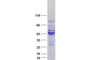 Validation with Western Blot (ACTC1 Protein (Myc-DYKDDDDK Tag))