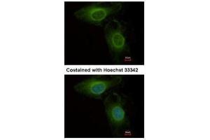 ICC/IF Image Immunofluorescence analysis of methanol-fixed HeLa, using PHGDH, antibody at 1:500 dilution.