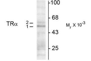 Western Blotting (WB) image for anti-Thyroid Hormone Receptor, alpha (THRA) (N-Term) antibody (ABIN371843) (THRA Antikörper  (N-Term))