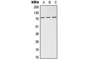 Western blot analysis of NDC80 expression in HEK293T (A), SP2/0 (B), H9C2 (C) whole cell lysates. (NDC80 Antikörper  (Center))