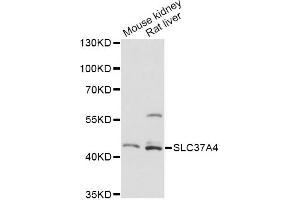 Western blot analysis of extracts of various cell lines, using SLC37A4 antibody. (SLC37A4 Antikörper)