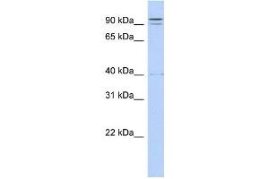 WB Suggested Anti-TTC14 Antibody Titration:  0. (TTC14 Antikörper  (N-Term))