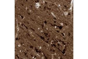 Immunohistochemical staining of human cerebral cortex with HS6ST2 polyclonal antibody  shows strong cytoplasmic positivity in neuronal cells at 1:50-1:200 dilution. (HS6ST2 Antikörper)