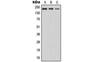 Western blot analysis of MAST2 expression in K562 (A), HeLa (B), Jurkat (C) whole cell lysates. (MAST2 Antikörper  (Center))