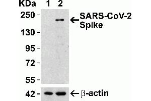 Overexpression Validation in Spike Transfected 293 Cells Loading: 10 μg per lane of 293 cell lysate. (SARS-CoV-2 Spike Antikörper  (RBD))