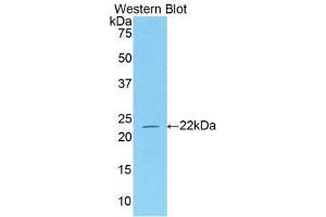 Western Blotting (WB) image for anti-Neuropilin 1 (NRP1) (AA 645-821) antibody (ABIN1173426) (Neuropilin 1 Antikörper  (AA 645-821))