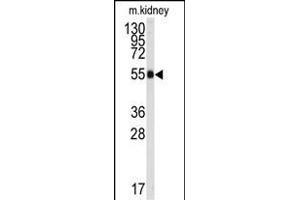 Western blot analysis of anti-ALDH9A1 Antibody (C-term) (ABIN392321 and ABIN2841971) in mouse kidney tissue lysates (35 μg/lane).