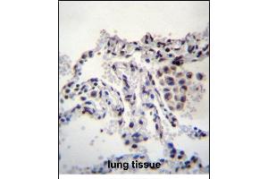 MEIG1 Antibody (Center) (ABIN656380 and ABIN2845675) immunohistochemistry analysis in formalin fixed and paraffin embedded human lung tissue followed by peroxidase conjugation of the secondary antibody and DAB staining. (MEIG1 Antikörper  (AA 36-65))