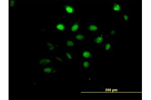 Immunofluorescence of monoclonal antibody to AKT1 on HeLa cell.