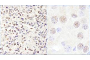 Immunohistochemistry (IHC) image for anti-Chromodomain Helicase DNA Binding Protein 3 (CHD3) (AA 1950-2000) antibody (ABIN7454393)