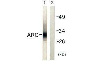 Western blot analysis of extracts from HeLa cells, using ARC antibody. (ARC Antikörper)