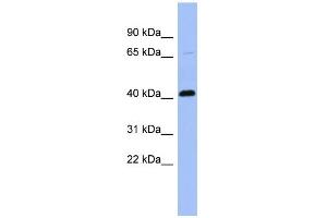 WB Suggested Anti-CFP Antibody Titration: 0. (CFP Antikörper  (N-Term))