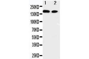Anti-ErbB 4 antibody, Western blotting Lane 1: A549 Cell Lysate Lane 2: HELA Cell Lysate (ERBB4 Antikörper  (N-Term))