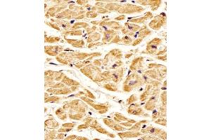 Antibody staining ROR1 in Human heart tissue sections by Immunohistochemistry (IHC-P - paraformaldehyde-fixed, paraffin-embedded sections). (ROR1 Antikörper)