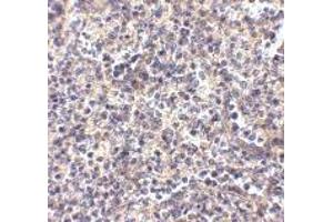 Immunohistochemistry (IHC) image for anti-ATG5 Autophagy Related 5 (ATG5) (N-Term) antibody (ABIN1031248)