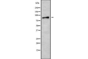 Western blot analysis of AMPD3 using MCF7 whole cell lysates (AMPD3 Antikörper  (Internal Region))