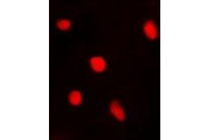 Immunofluorescent analysis of BTEB1 staining in A549 cells.