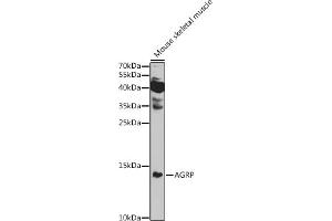 Western blot analysis of extracts of Mouse skeletal muscle, using AGRP antibody (ABIN7265515) at 1:1000 dilution. (AGRP Antikörper  (AA 21-132))