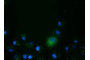 Anti-CD80 mouse monoclonal antibody (ABIN2452902) immunofluorescent staining of COS7 cells transiently transfected by pCMV6-ENTRY CD80 (RC206540). (CD80 Antikörper)