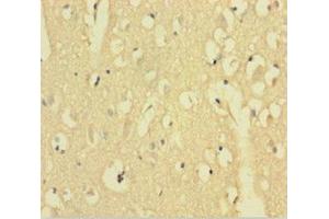 Immunohistochemistry of paraffin-embedded human brain tissue using ABIN7143589 at dilution of 1:100 (Aftiphilin Antikörper  (AA 752-889))