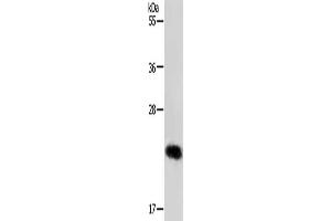 Gel: 12 % SDS-PAGE, Lysate: 40 μg, Lane: MCF7 cells, Primary antibody: ABIN7192097(RAB22A Antibody) at dilution 1/650, Secondary antibody: Goat anti rabbit IgG at 1/8000 dilution, Exposure time: 30 seconds (RAB22A Antikörper)
