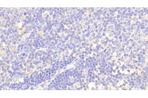 Immunohistochemistry (IHC) image for anti-Matrix Metallopeptidase 13 (Collagenase 3) (MMP13) (AA 290-468) antibody (ABIN7438484)