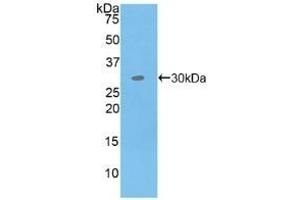 Detection of Recombinant MAP4K5, Human using Polyclonal Antibody to Mitogen Activated Protein Kinase Kinase Kinase Kinase 5 (MAP4K5) (MAP4K5 Antikörper  (AA 613-842))