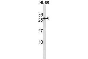 TMED6 Antibody (Center) western blot analysis in HL-60 cell line lysates (35 µg/lane). (TMED6 Antikörper  (Middle Region))