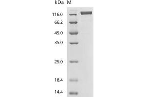 Folate Hydrolase (Prostate-Specific Membrane Antigen) 1 (FOLH1) (AA 44-751) protein (hFc Tag)
