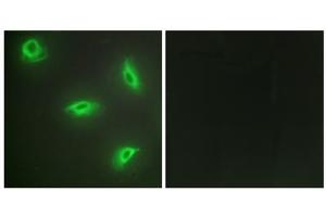 Immunofluorescence analysis of HeLa cells, using TNF14 antibody. (TNFSF14 Antikörper  (Internal Region))