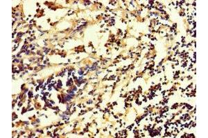 Immunohistochemistry of paraffin-embedded human appendix tissue using ABIN7154641 at dilution of 1:100 (RHEBL1 Antikörper  (AA 1-180))