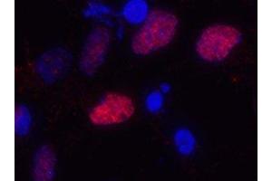 Immunostaining of primary rat cortical neuroepithelial cells with anti-Olig2 (red). (OLIG2 Antikörper)
