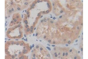 Detection of IREB2 in Human Kidney Tissue using Polyclonal Antibody to Iron Responsive Element Binding Protein 2 (IREB2) (IREB2 Antikörper  (AA 39-281))