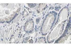 ABIN6274786 at 1/100 staining Human prostate tissue by IHC-P. (PGLS Antikörper  (C-Term))