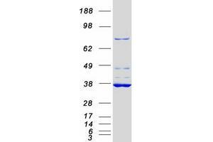 Validation with Western Blot