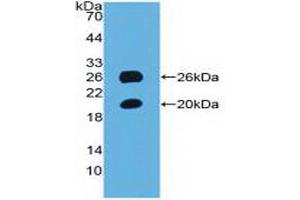 Detection of Recombinant SPON1, Mouse using Polyclonal Antibody to Spondin 1 (SPON1) (SPON1 Antikörper  (AA 608-802))